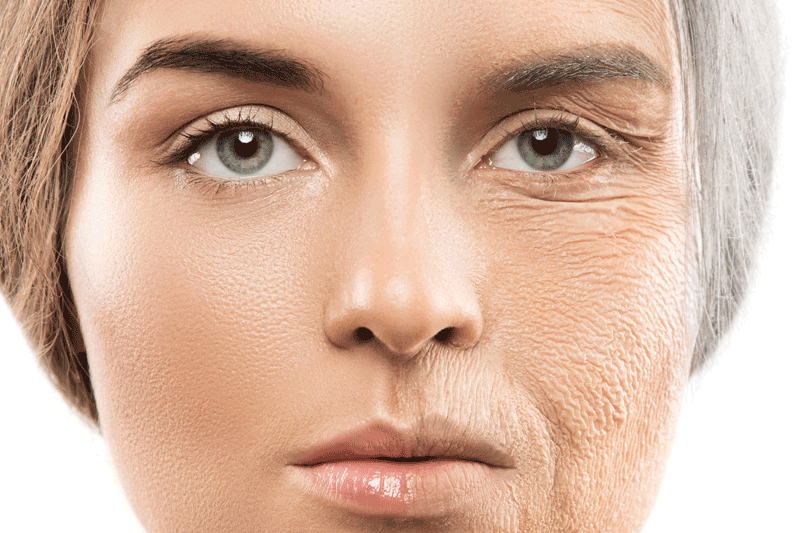 The major signs of stress affected ageing skin