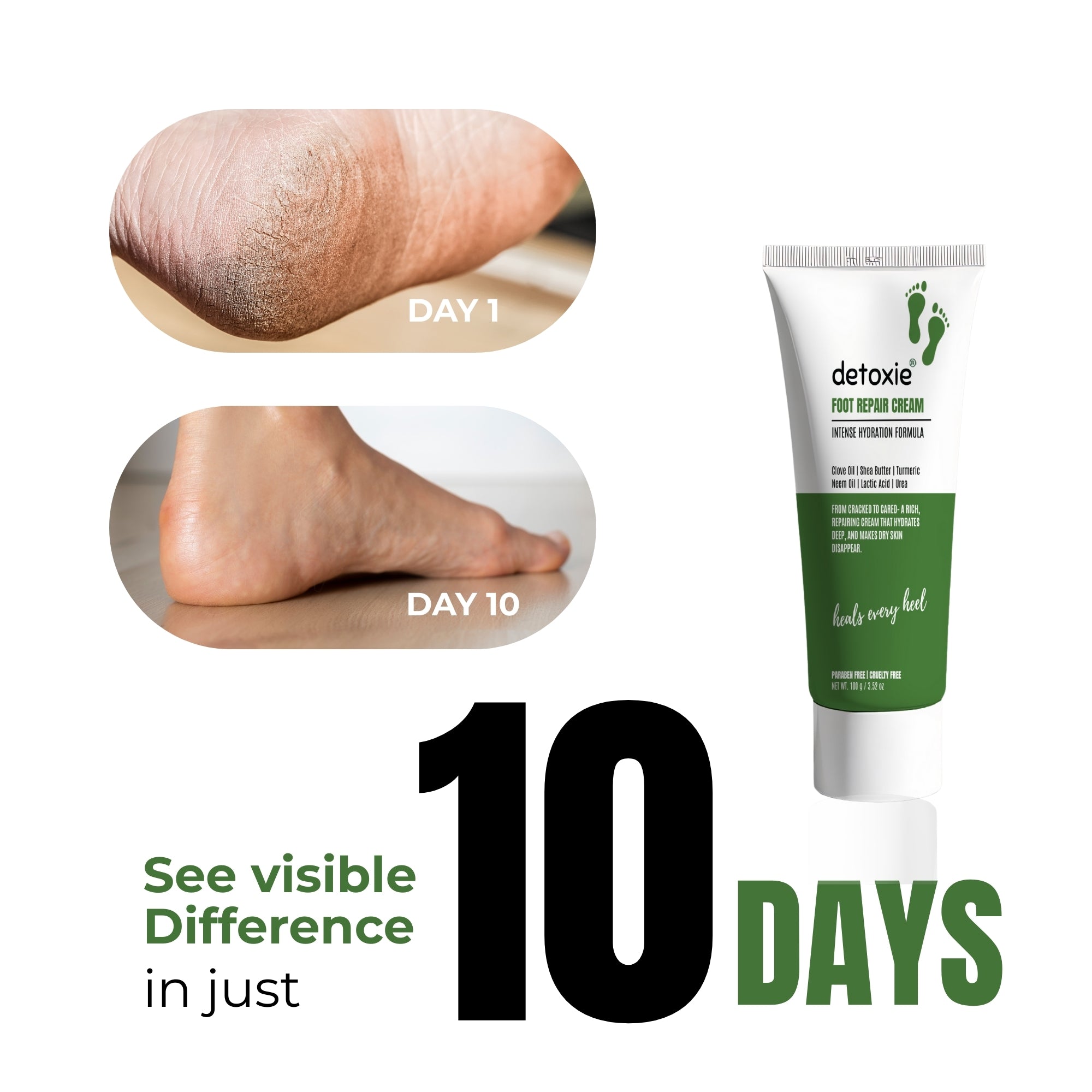 Foot Repair & Softening Cream -100g